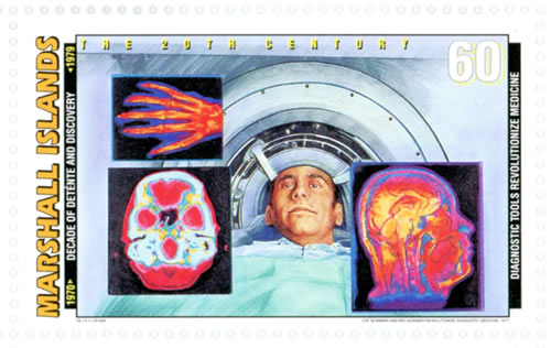 débuts de l'imagerie médicale